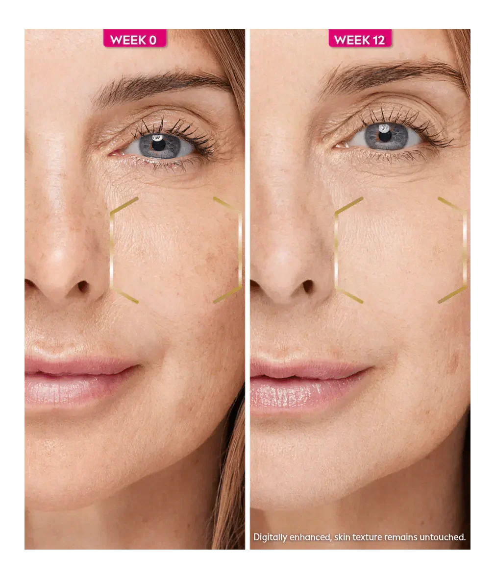 Nivea Luminous 630 Anti Dark Spot Night Cream  50ml / 1.7 fl oz - 3 Pack