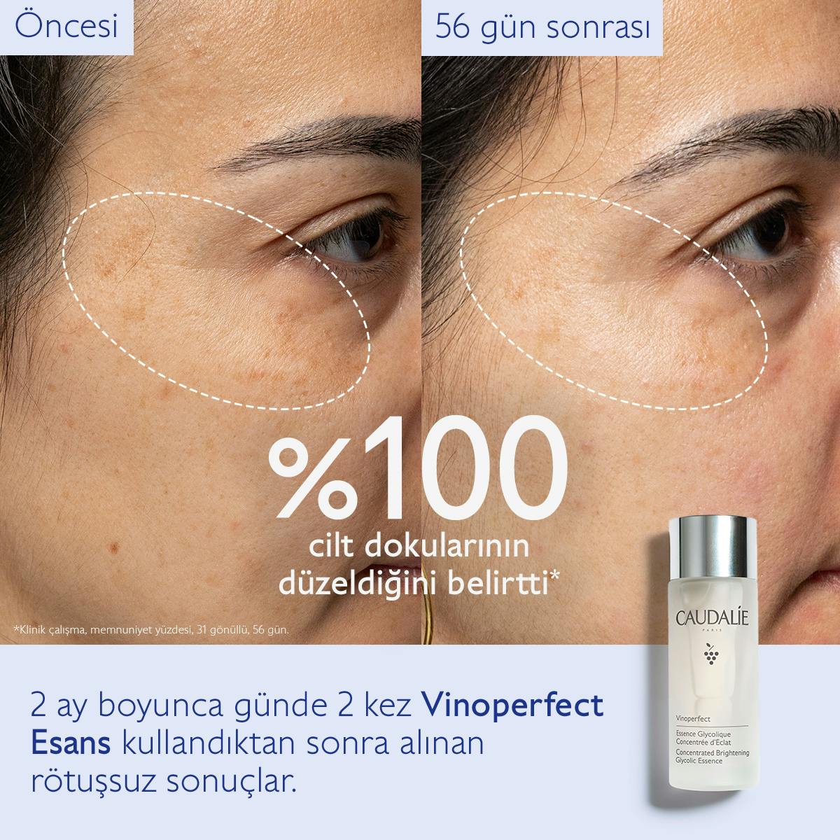 Caudalie Vinoperfect Leke Karşıtı ve Işıltı Verici Glikolik Esans 150 ml - Melori