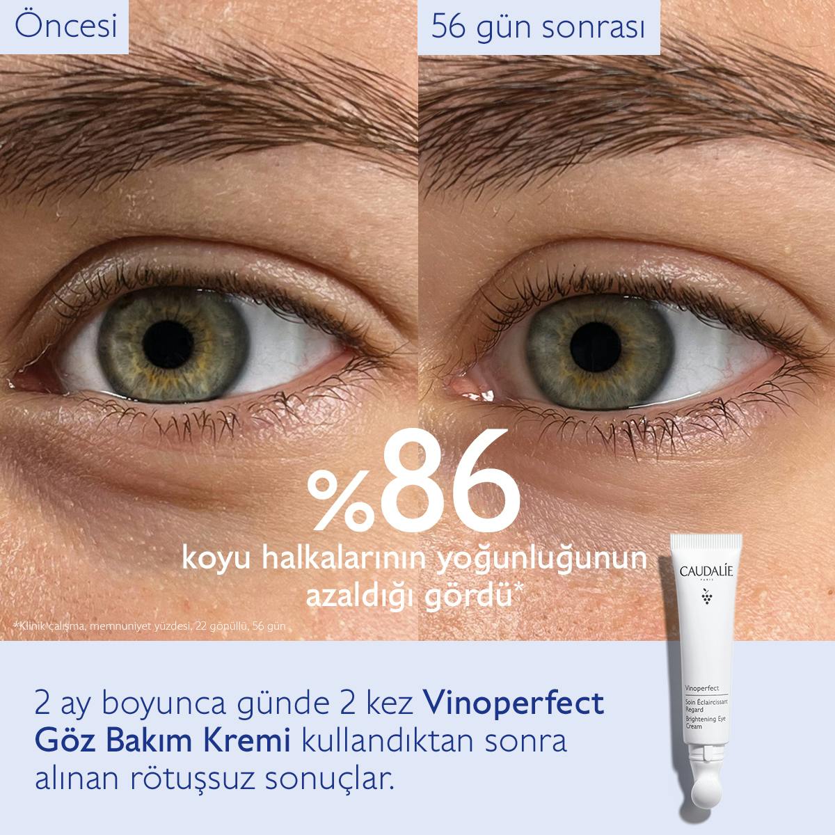 Caudalie Vinoperfect Işıltı Verici Göz Bakım Kremi 15 ml - Melori
