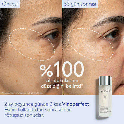 Caudalie Vinoperfect Leke Karşıtı ve Işıltı Verici Glikolik Esans 150 ml - Melori