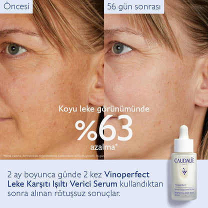 Caudalie Vinoperfect Leke Karşıtı ve Işıltı Verici Serum 30 ml - Melori