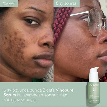 Caudalie Vinopure Blemish Control Salicylic Serum 30 ml - Melori