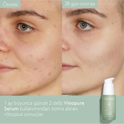 Caudalie Vinopure Blemish Control Salicylic Serum 30 ml - Melori