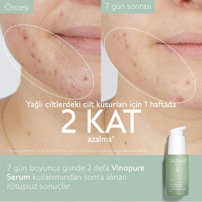 Caudalie Vinopure Blemish Control Salicylic Serum 30 ml - Melori