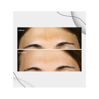 Dermalogica PowerBright Koyu Lekeler İçin Bakım Serumu 30 ml - Melori