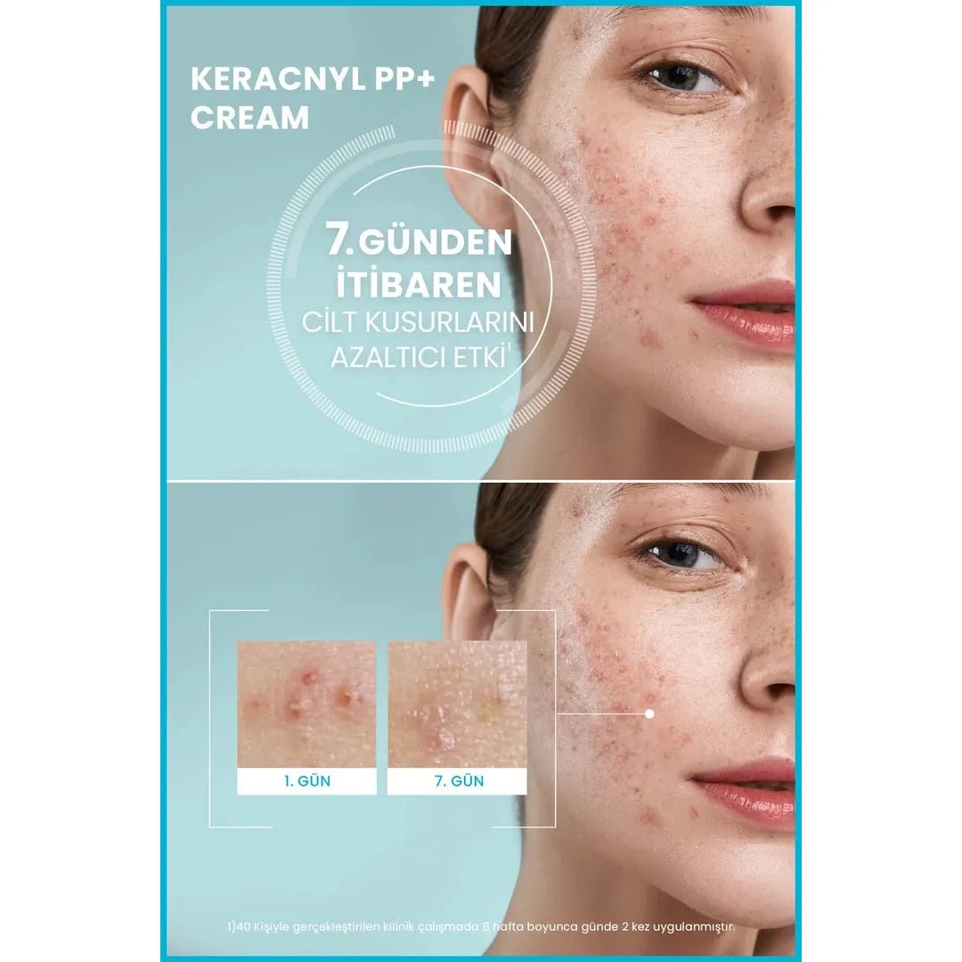 Ducray Keracnyl PP+ Akneye Eğilimli Ciltler İçin Bakım Kremi 30 ml - Melori