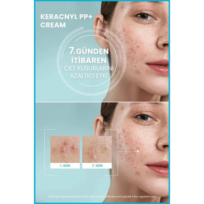 Ducray Keracnyl PP+ Akneye Eğilimli Ciltler İçin Bakım Kremi 30 ml - Melori