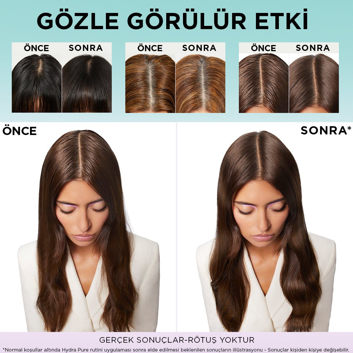Loreal Paris Elseve Hydra [Hyaluronic] Pure Salisilik Asit İçeren Yağlanma Karşıtı Arındırıcı Şampuan 300ml - Melori