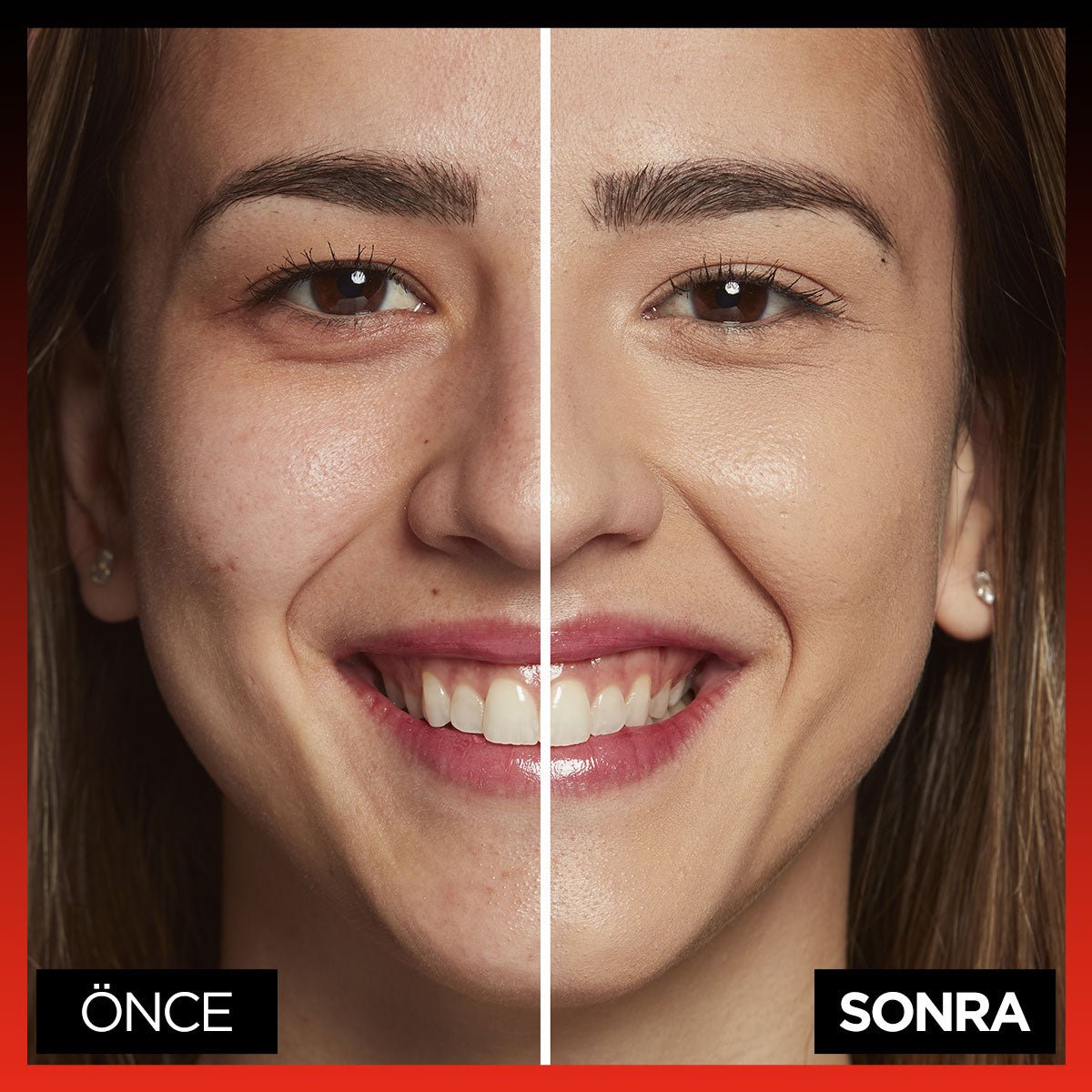 Loreal Paris Infaillible 24H Tüm Yüze Uygulanabilir Kapatıcı - 330 Pecan - Melori