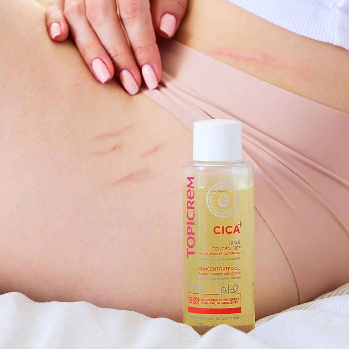 Topicrem CICA Concentrated Oil 100 ml - Melori